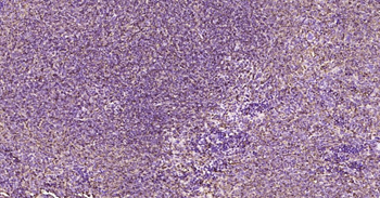 GLUT1 Recombinant Rabbit Monoclonal Antibody