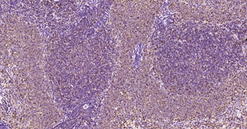 GLUT1 Recombinant Rabbit Monoclonal Antibody