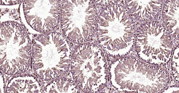 GLUT1 Recombinant Rabbit Monoclonal Antibody