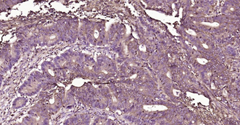 GLUT1 Recombinant Rabbit Monoclonal Antibody