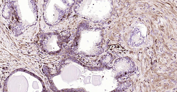 GLUT1 Recombinant Rabbit Monoclonal Antibody