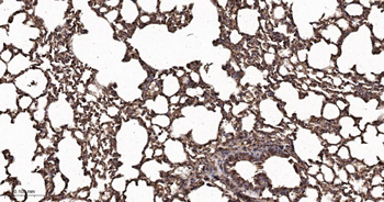 GLUT1 Recombinant Rabbit Monoclonal Antibody