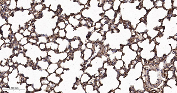 GLUT1 Recombinant Rabbit Monoclonal Antibody