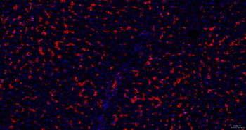 GLUT1 Recombinant Rabbit Monoclonal Antibody