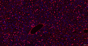 GLUT1 Recombinant Rabbit Monoclonal Antibody