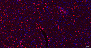 GLUT1 Recombinant Rabbit Monoclonal Antibody