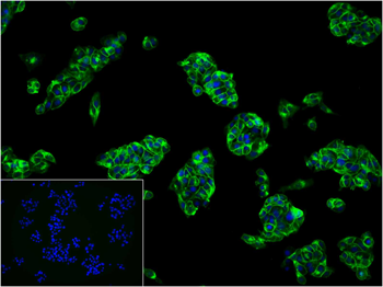 GLUT1 Recombinant Rabbit Monoclonal Antibody