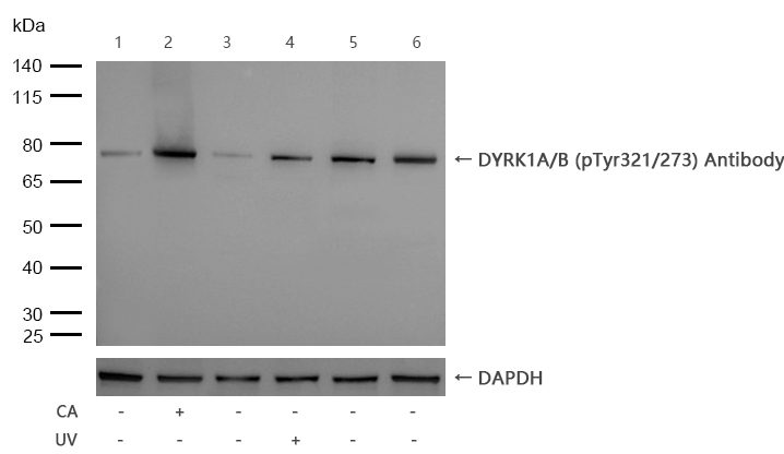 DYRK1A/B (Phospho-Tyr321/273) Antibody
