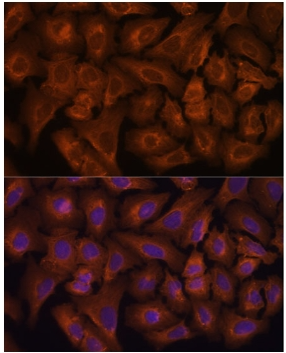 NEXN Polyclonal Antibody
