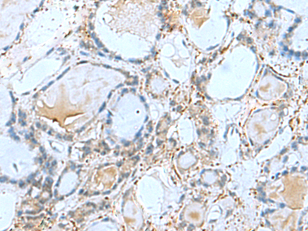 GPCPD1 antibody