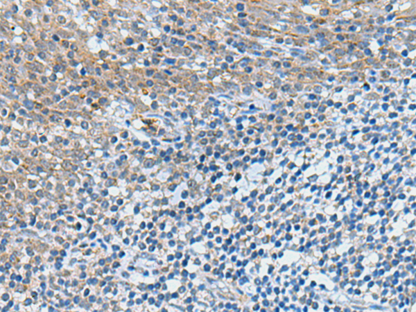 GPCPD1 antibody