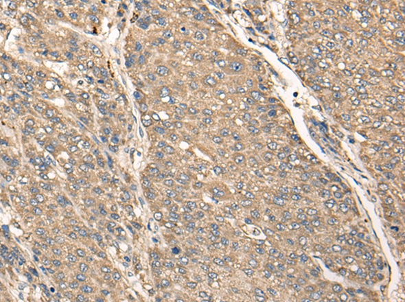 C17orf67 Antibody
