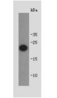 Shiga toxin subunit B Antibody