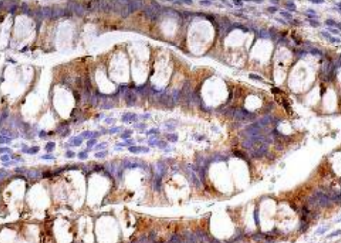TNFR1 Antibody