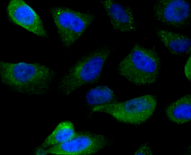 IMPDH2 Antibody