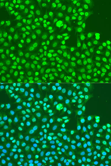 Phospho-DNA-PKcs-S2056 polyclonal antibody