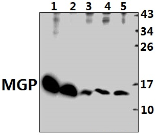MGP polyclonal antibody