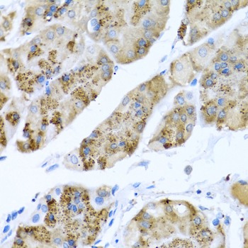 MGP polyclonal antibody