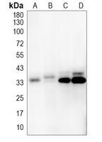 COX1 Rabbit Polyclonal Antibody