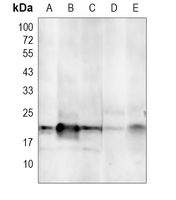 Aquaporin 5 Rabbit Polyclonal Antibody