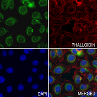 Aquaporin 5 Rabbit Polyclonal Antibody