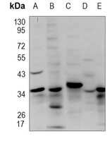 ALG5 Rabbit Polyclonal Antibody