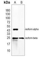 CHPT1 Rabbit Polyclonal Antibody