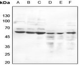 Estrogen Receptor beta (Phospho-S105) polyclonal antibody