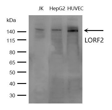 LORF2 Rabbit Polyclonal Antibody