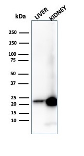 RBP4 / Retinol Binding Protein 4 Antibody