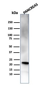 RBP4 / Retinol Binding Protein 4 Antibody