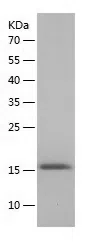 Human Fibronectin type III EDB protein