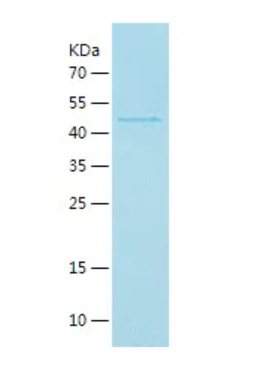 Mouse METRNL protein