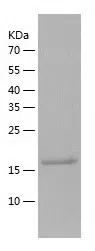 Human Sclerostin protein