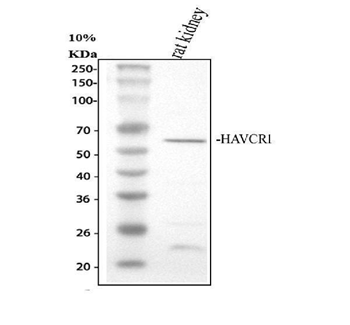 TIM 1/HAVCR1 Rabbit Polyclonal Antibody