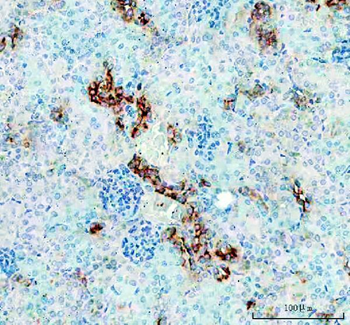 TIM 1/HAVCR1 Rabbit Polyclonal Antibody