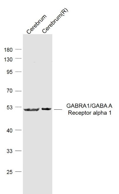 GABA A Recpetor alpha 1 antibody
