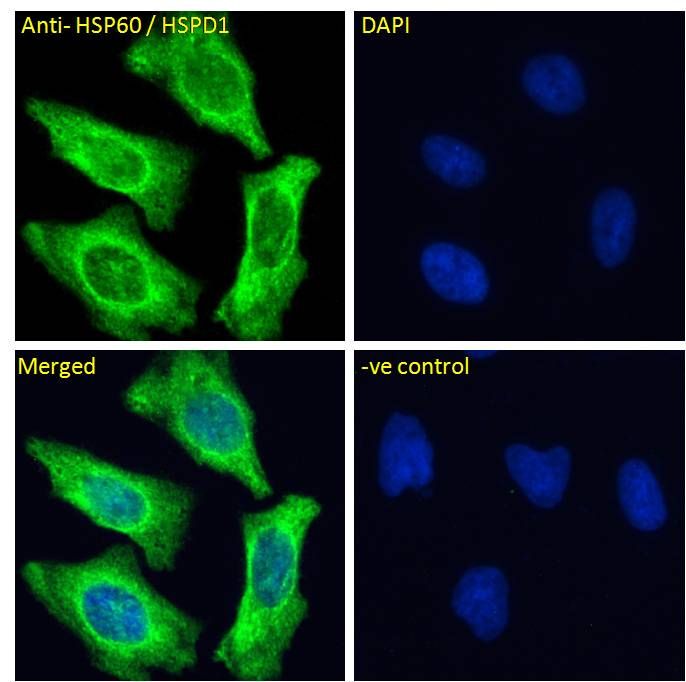 HSPD1 antibody