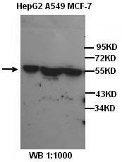 β-Tubulin Antibody