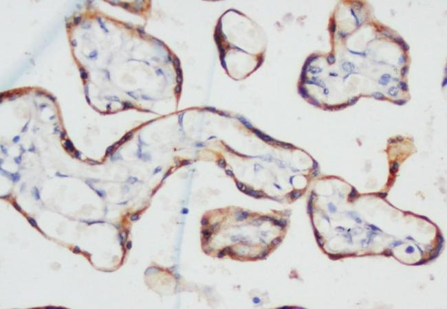 PCK Mouse Monoclonal Antibody