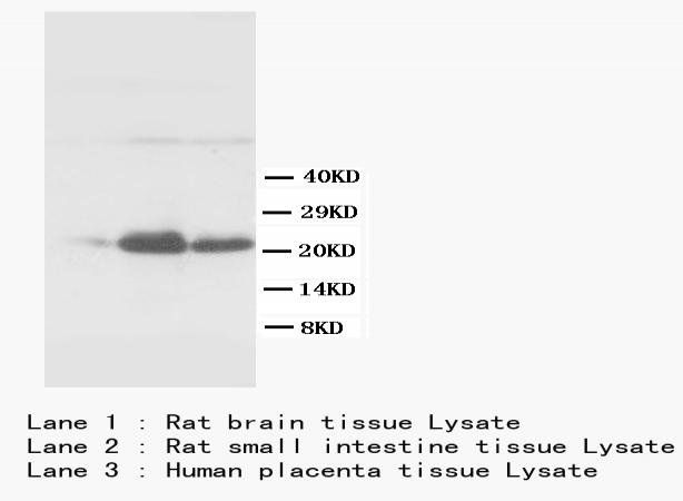 S-100 S100b/100 Mouse Monoclonal Antibody