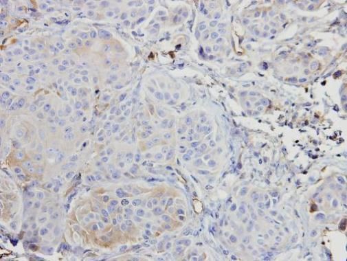 A-RAF antibody [C1C3]