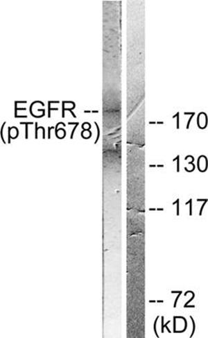 EGFR (Phospho-Thr678) antibody