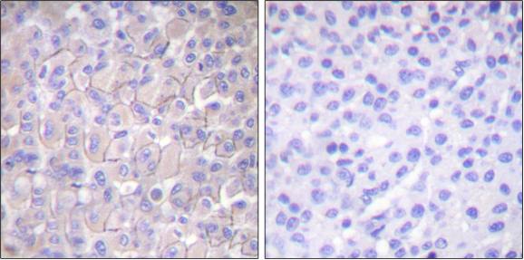 EGFR (Phospho-Thr693) antibody