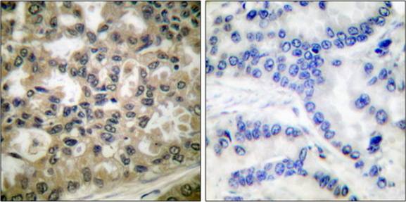 I kappa B-beta (Phospho-Ser23) antibody