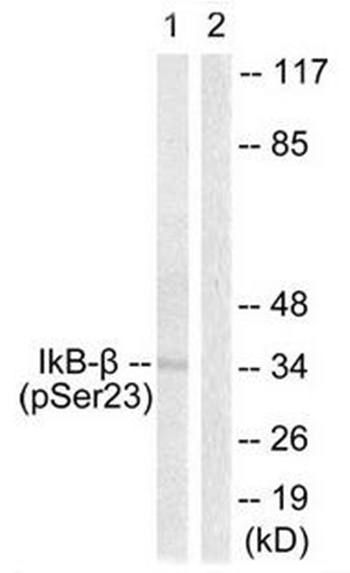I kappa B-beta (Phospho-Ser23) antibody
