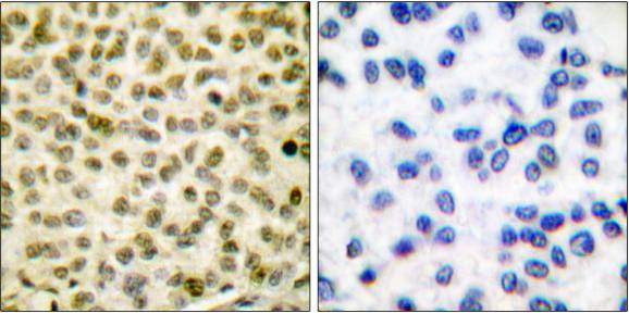 Myc (Phospho-Ser62) Antibody
