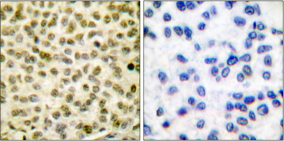 Myc (Phospho-Ser62) antibody