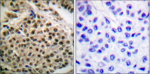 NF-κB p105/p50 (Phospho-Ser927) Antibody