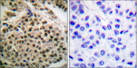 NF-kappa B p105/p50 (Phospho-Ser927) antibody